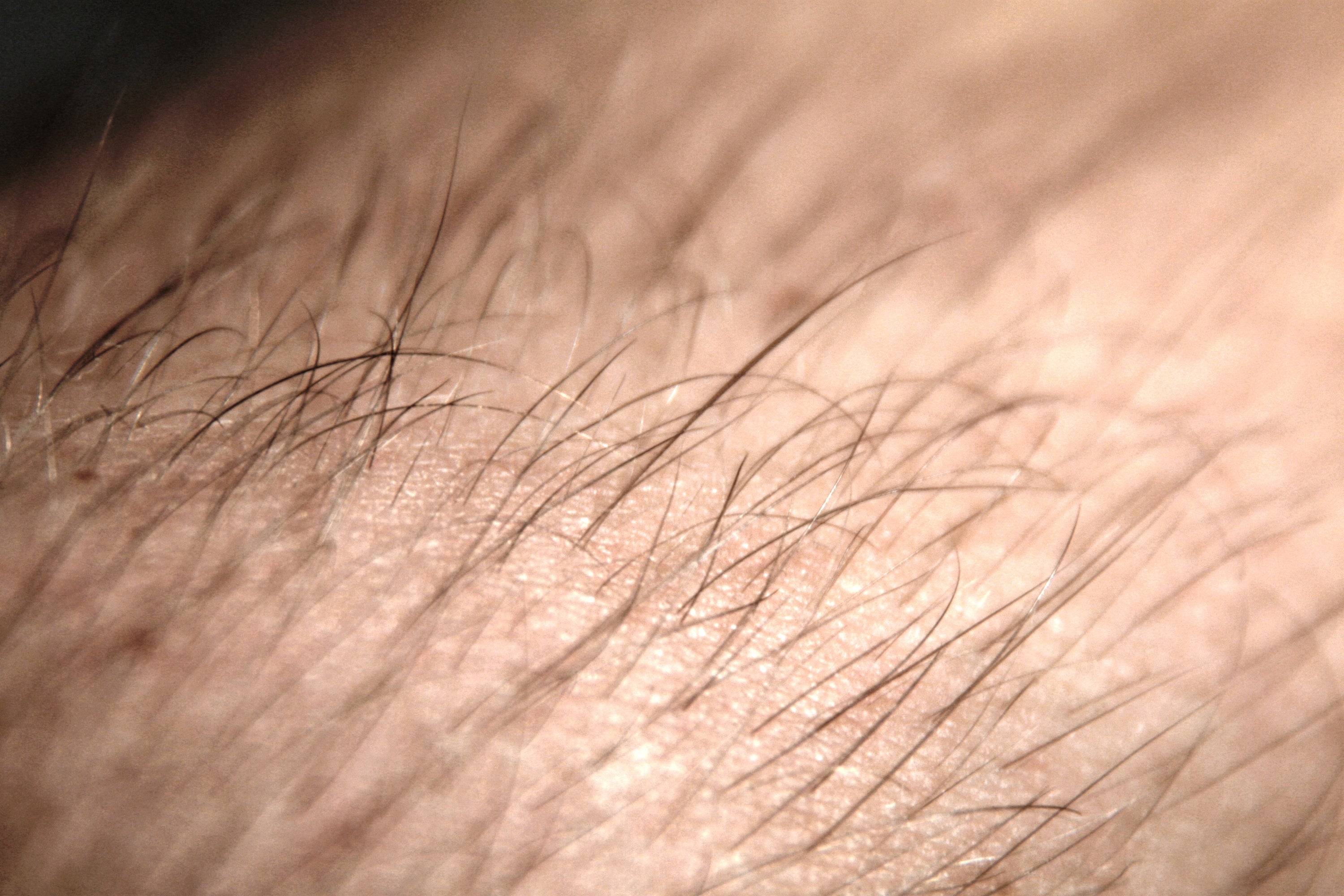 Trichology Unveiled: The Science Behind Hair Growth and Loss