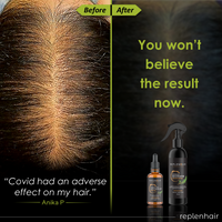 Rosemary Rice Water Anti-Hair Loss Bundle | Reduces Hair Loss - Replenhair